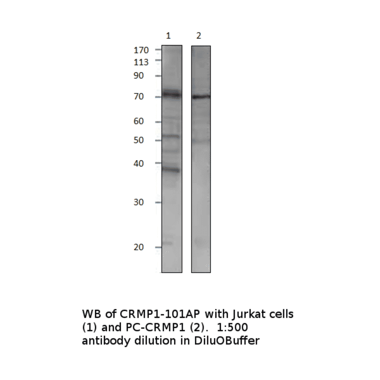 Anti-CRMP1 Antibody from FabGennix (CRMP1-101AP) - Antibodies.com