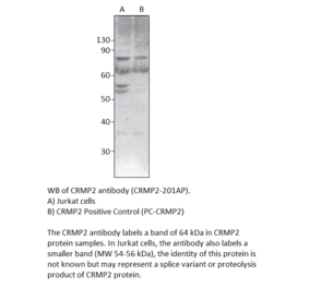 Anti-CRMP2 Antibody from FabGennix (CRMP2-201AP) - Antibodies.com