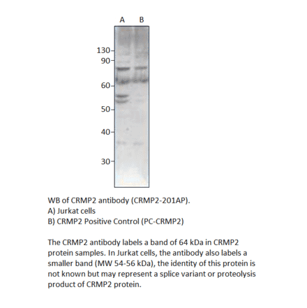 Anti-CRMP2 Antibody from FabGennix (CRMP2-201AP) - Antibodies.com