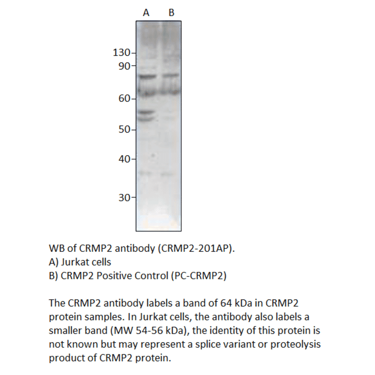 Anti-CRMP2 Antibody from FabGennix (CRMP2-201AP) - Antibodies.com