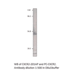 Anti-CXCR2 Antibody from FabGennix (CXCR2-201AP) - Antibodies.com