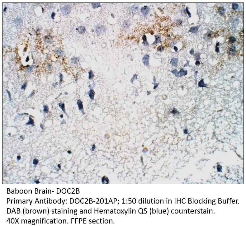 Anti-DOC2B Antibody