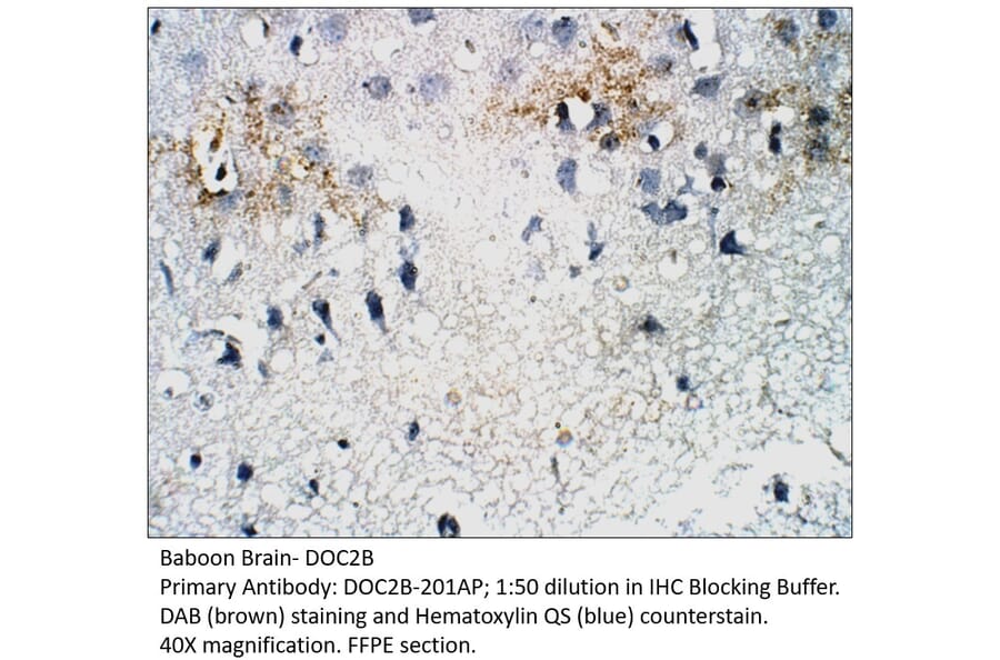Anti-DOC2B Antibody from FabGennix (DOC2B-201AP) - Antibodies.com