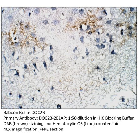 Anti-DOC2B Antibody from FabGennix (DOC2B-201AP) - Antibodies.com