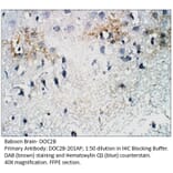 Anti-DOC2B Antibody from FabGennix (DOC2B-201AP) - Antibodies.com