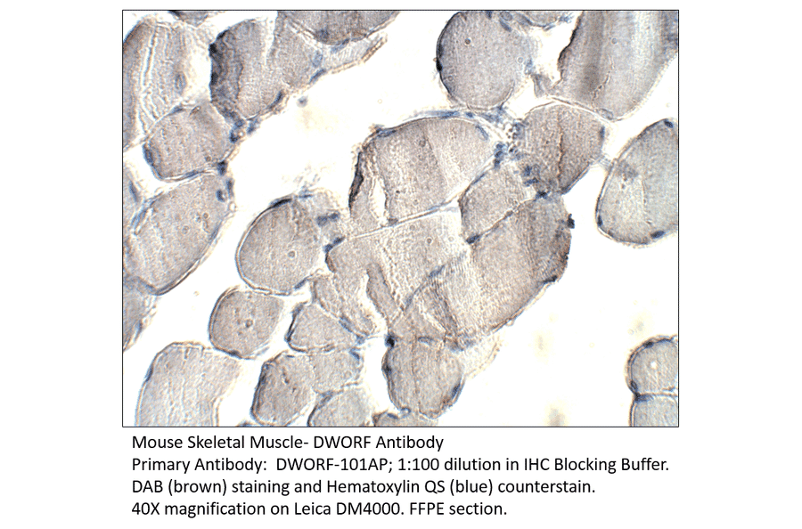 Anti-DWORF Antibody from FabGennix (DWORF-101AP) - Antibodies.com