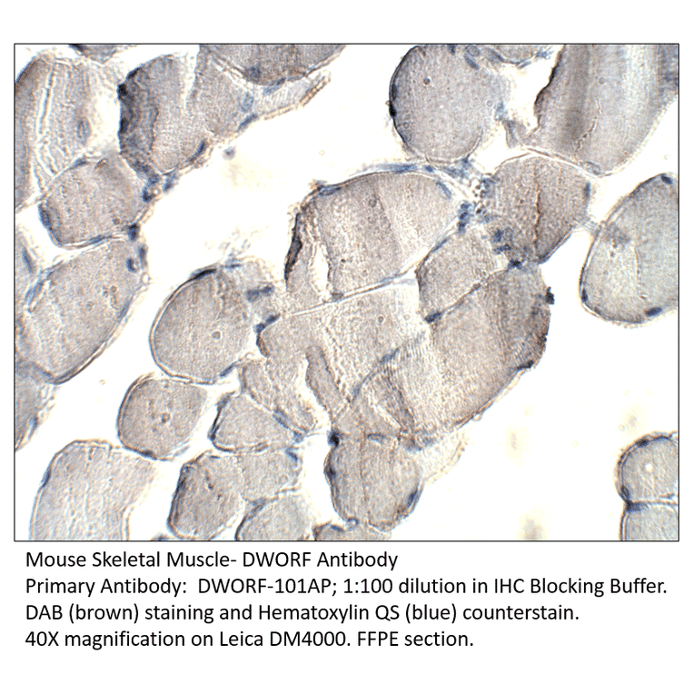 Anti-DWORF Antibody from FabGennix (DWORF-101AP) - Antibodies.com