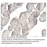 Anti-DWORF Antibody from FabGennix (DWORF-101AP) - Antibodies.com