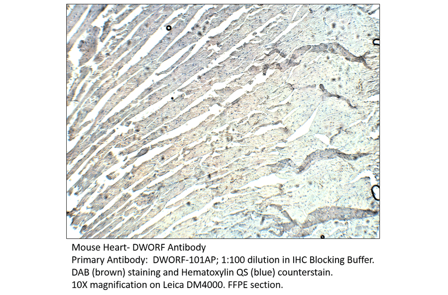 Anti-DWORF Antibody from FabGennix (DWORF-101AP) - Antibodies.com