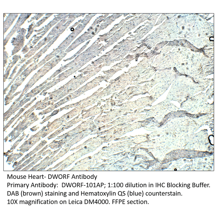 Anti-DWORF Antibody from FabGennix (DWORF-101AP) - Antibodies.com