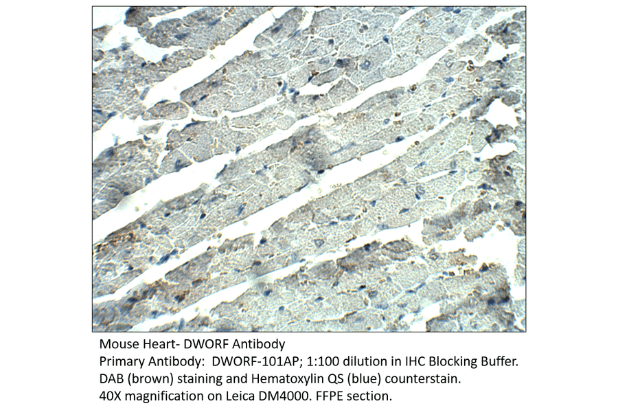 Anti-DWORF Antibody from FabGennix (DWORF-101AP) - Antibodies.com