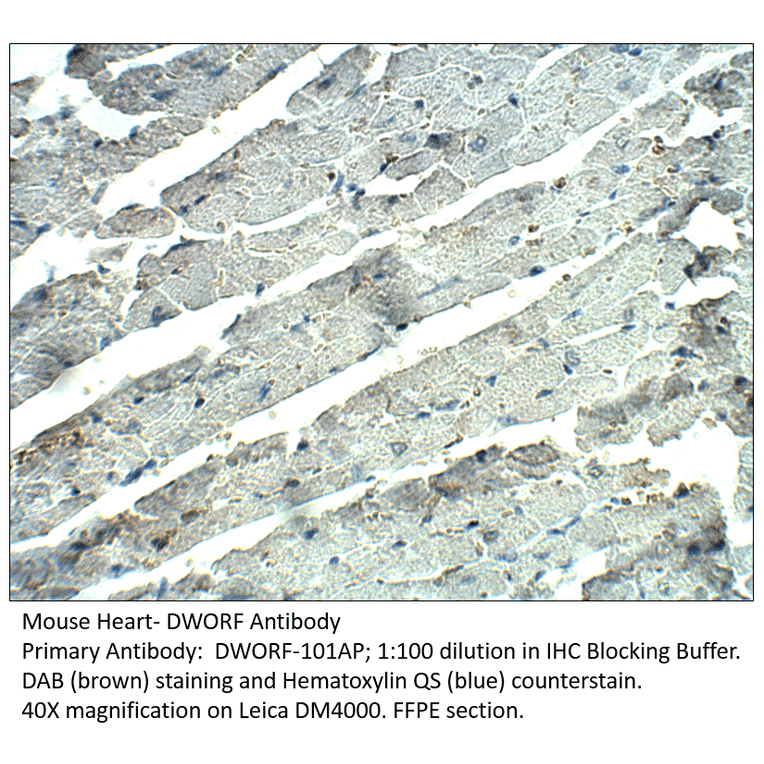 Anti-DWORF Antibody from FabGennix (DWORF-101AP) - Antibodies.com