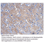 Anti-EAAT1 Antibody from FabGennix (EAAT1-101AP) - Antibodies.com
