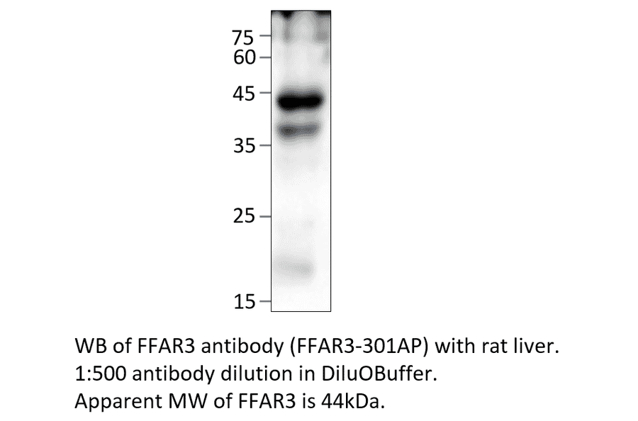 Anti-FFAR3 Antibody from FabGennix (FFAR3-301AP) - Antibodies.com