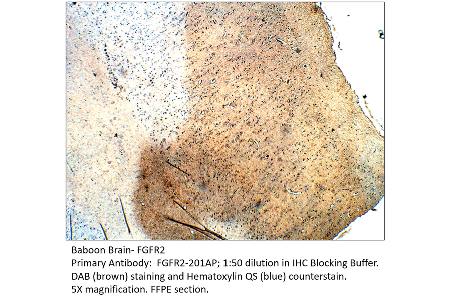 Anti-FGFR2 Antibody from FabGennix (FGFR2-201AP) - Antibodies.com