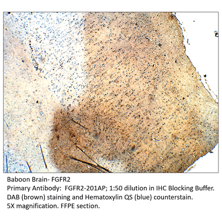 Anti-FGFR2 Antibody from FabGennix (FGFR2-201AP) - Antibodies.com