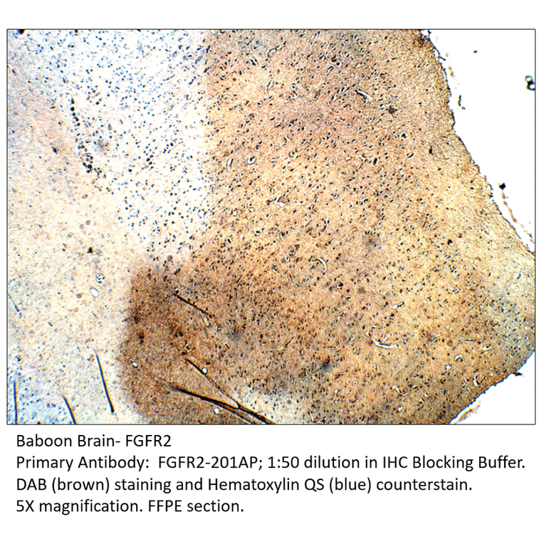 Anti-FGFR2 Antibody from FabGennix (FGFR2-201AP) - Antibodies.com