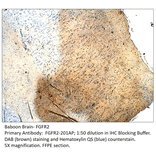 Anti-FGFR2 Antibody from FabGennix (FGFR2-201AP) - Antibodies.com