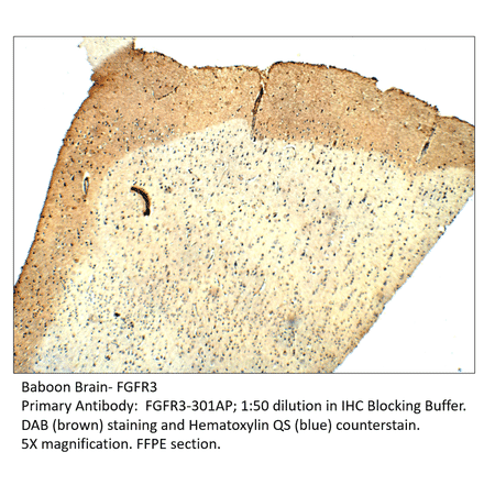 Anti-FGFR3 Antibody from FabGennix (FGFR3-301AP) - Antibodies.com