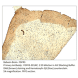 Anti-FGFR3 Antibody from FabGennix (FGFR3-301AP) - Antibodies.com