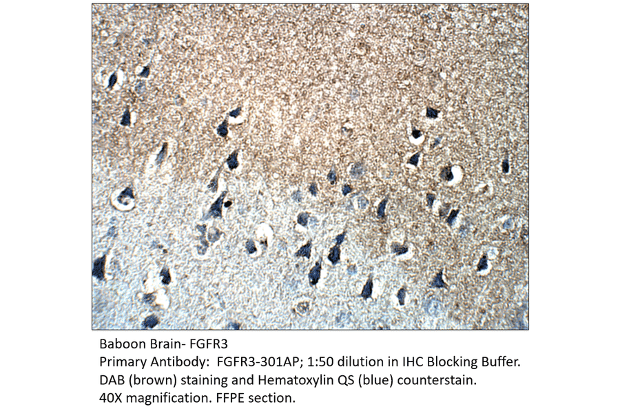 Anti-FGFR3 Antibody from FabGennix (FGFR3-301AP) - Antibodies.com