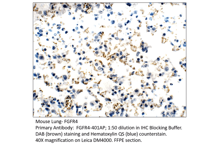 Anti-FGFR4 Antibody from FabGennix (FGFR4-401AP) - Antibodies.com