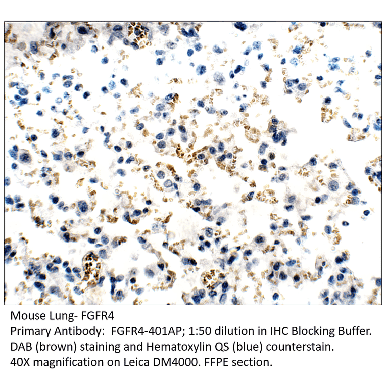 Anti-FGFR4 Antibody from FabGennix (FGFR4-401AP) - Antibodies.com