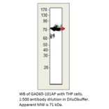 Anti-GAD65 Antibody from FabGennix (GAD65-101AP) - Antibodies.com