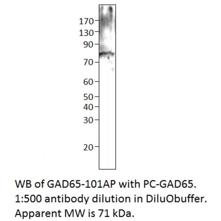 Anti-GAD65 Antibody from FabGennix (GAD65-101AP) - Antibodies.com