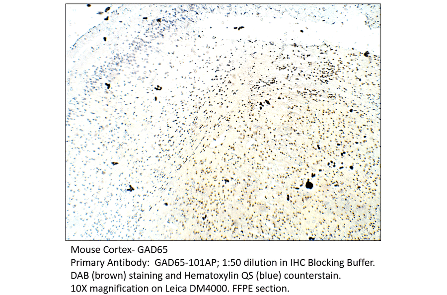 Anti-GAD65 Antibody from FabGennix (GAD65-101AP) - Antibodies.com
