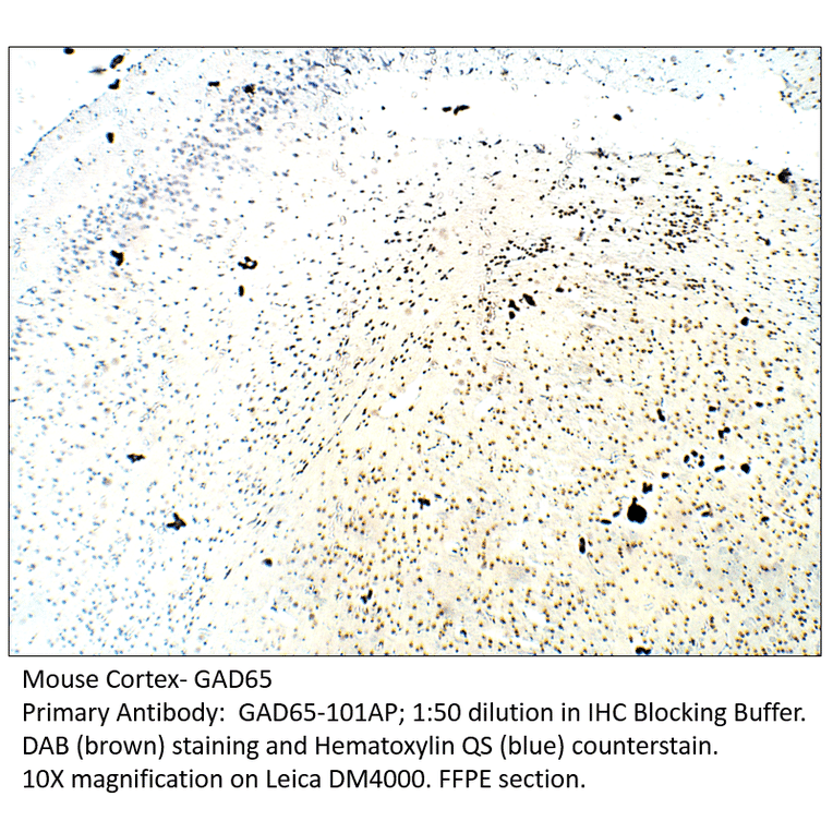 Anti-GAD65 Antibody from FabGennix (GAD65-101AP) - Antibodies.com