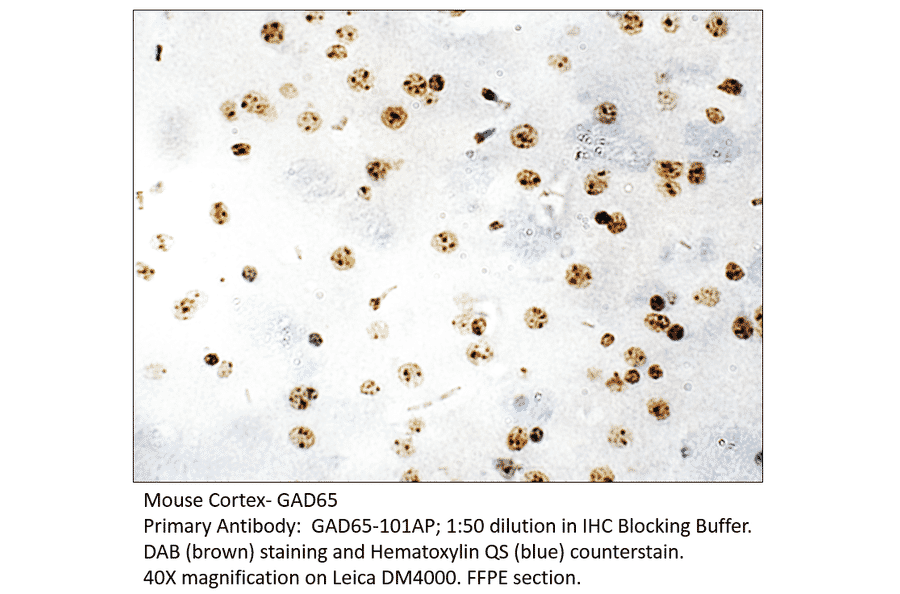 Anti-GAD65 Antibody from FabGennix (GAD65-101AP) - Antibodies.com