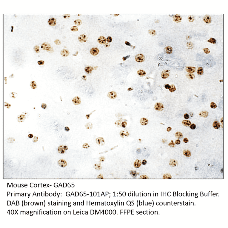 Anti-GAD65 Antibody from FabGennix (GAD65-101AP) - Antibodies.com