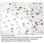 Anti-GAD65 Antibody from FabGennix (GAD65-101AP) - Antibodies.com