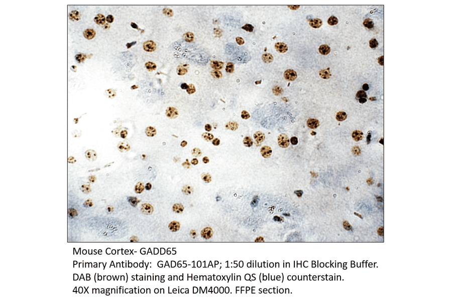 Anti-GAD65 Antibody from FabGennix (GAD65-101AP) - Antibodies.com