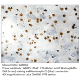 Anti-GAD65 Antibody from FabGennix (GAD65-101AP) - Antibodies.com