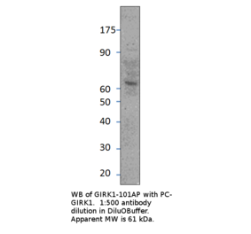 Anti-GIRK1 Antibody from FabGennix (GIRK1-101AP) - Antibodies.com