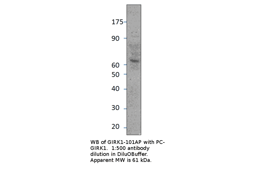Anti-GIRK1 Antibody from FabGennix (GIRK1-101AP) - Antibodies.com