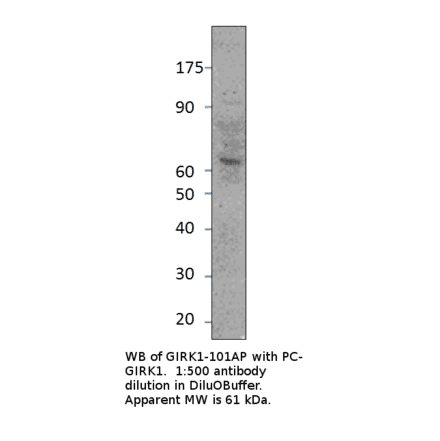 Anti-GIRK1 Antibody from FabGennix (GIRK1-101AP) - Antibodies.com