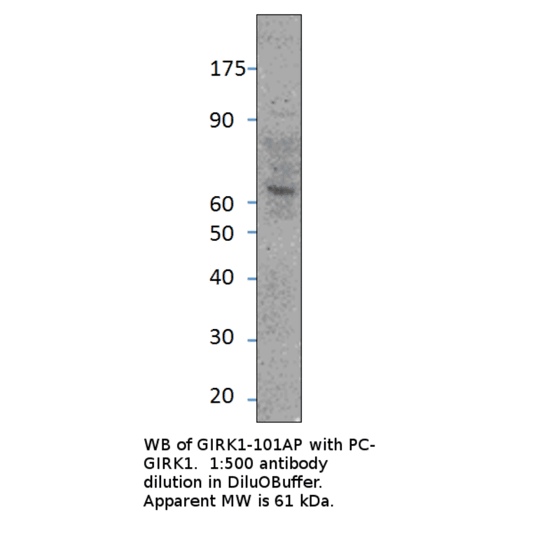 Anti-GIRK1 Antibody from FabGennix (GIRK1-101AP) - Antibodies.com