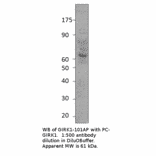 Anti-GIRK1 Antibody from FabGennix (GIRK1-101AP) - Antibodies.com
