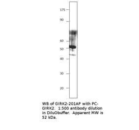 Anti-GIRK2 Antibody from FabGennix (GIRK2-201AP) - Antibodies.com