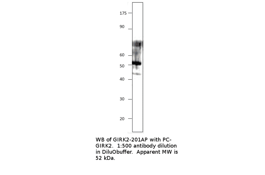 Anti-GIRK2 Antibody from FabGennix (GIRK2-201AP) - Antibodies.com