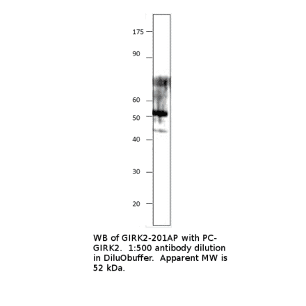 Anti-GIRK2 Antibody from FabGennix (GIRK2-201AP) - Antibodies.com