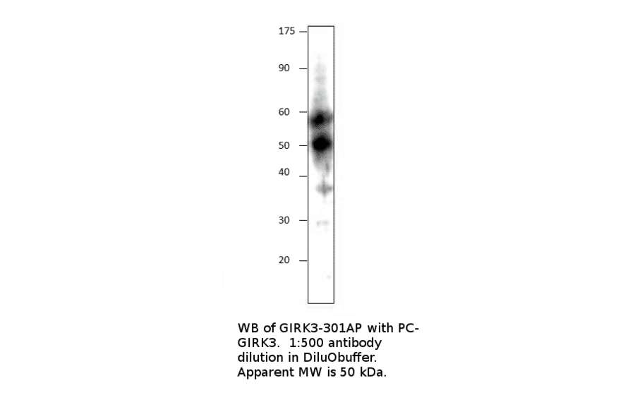 Anti-KCNJ2 Antibody from FabGennix (GIRK3-301AP) - Antibodies.com