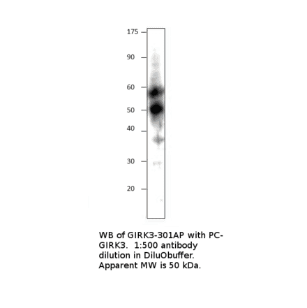 Anti-KCNJ2 Antibody from FabGennix (GIRK3-301AP) - Antibodies.com