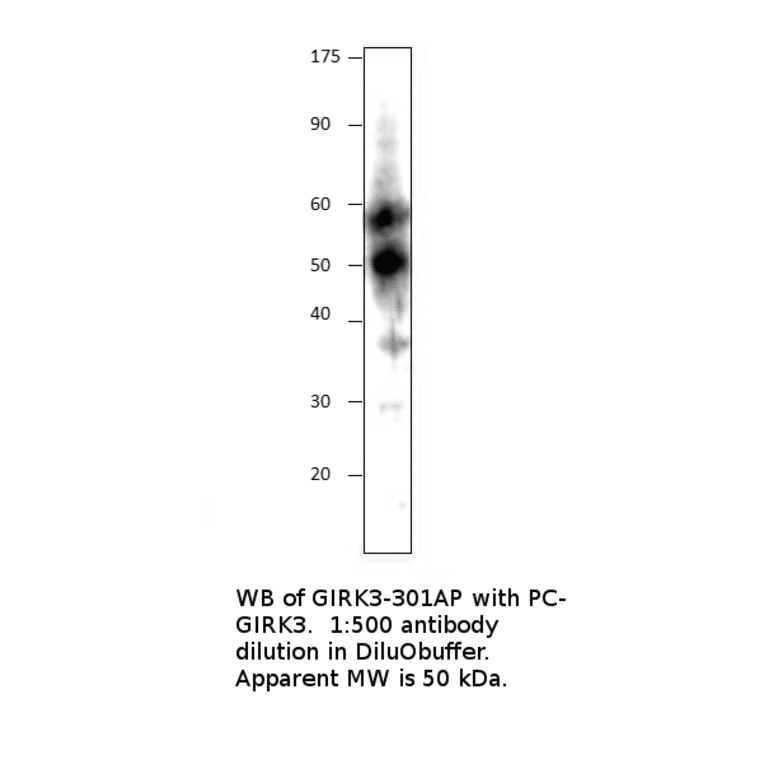 Anti-KCNJ2 Antibody from FabGennix (GIRK3-301AP) - Antibodies.com