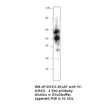 Anti-KCNJ2 Antibody from FabGennix (GIRK3-301AP) - Antibodies.com