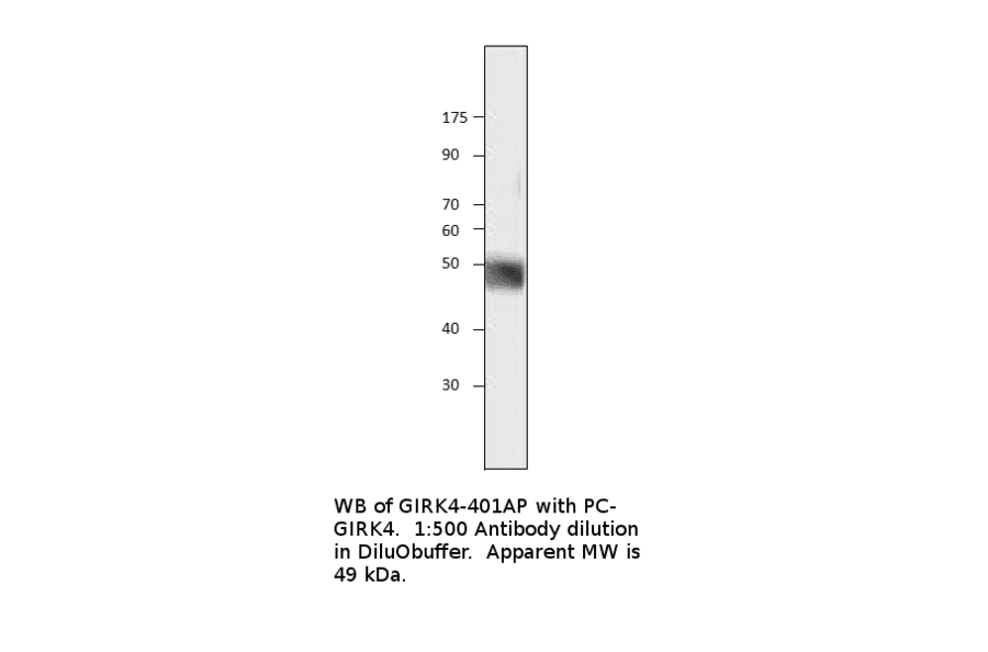 Anti-KCNJ5 Antibody from FabGennix (GIRK4-401AP) - Antibodies.com