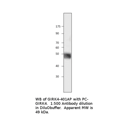 Anti-KCNJ5 Antibody from FabGennix (GIRK4-401AP) - Antibodies.com